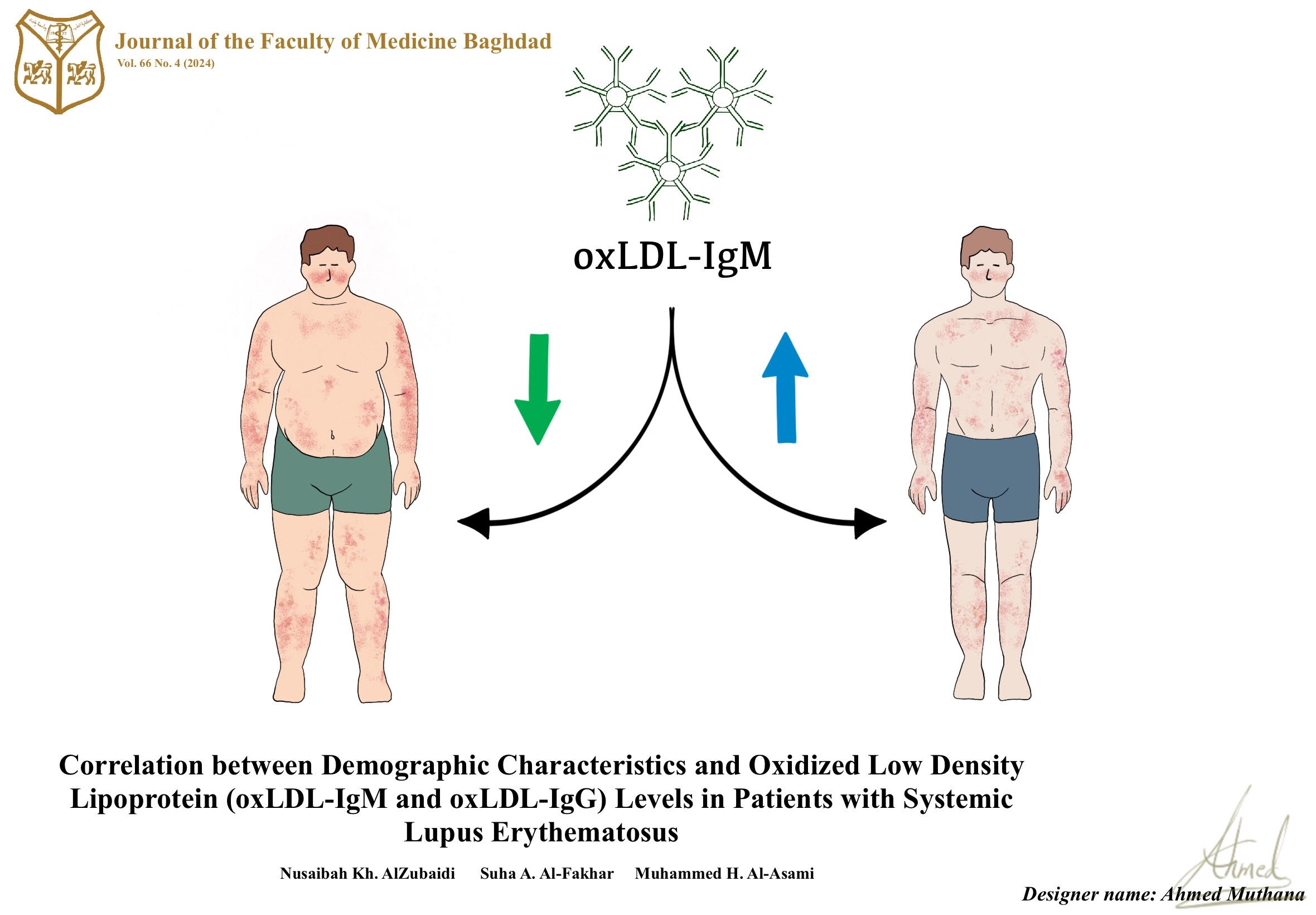 Immunoglobulins G; Immunoglobulins M; Oxidized Low-Density Lipoprotein antibody; Obesity, Systemic Lupus Erythematosus, 