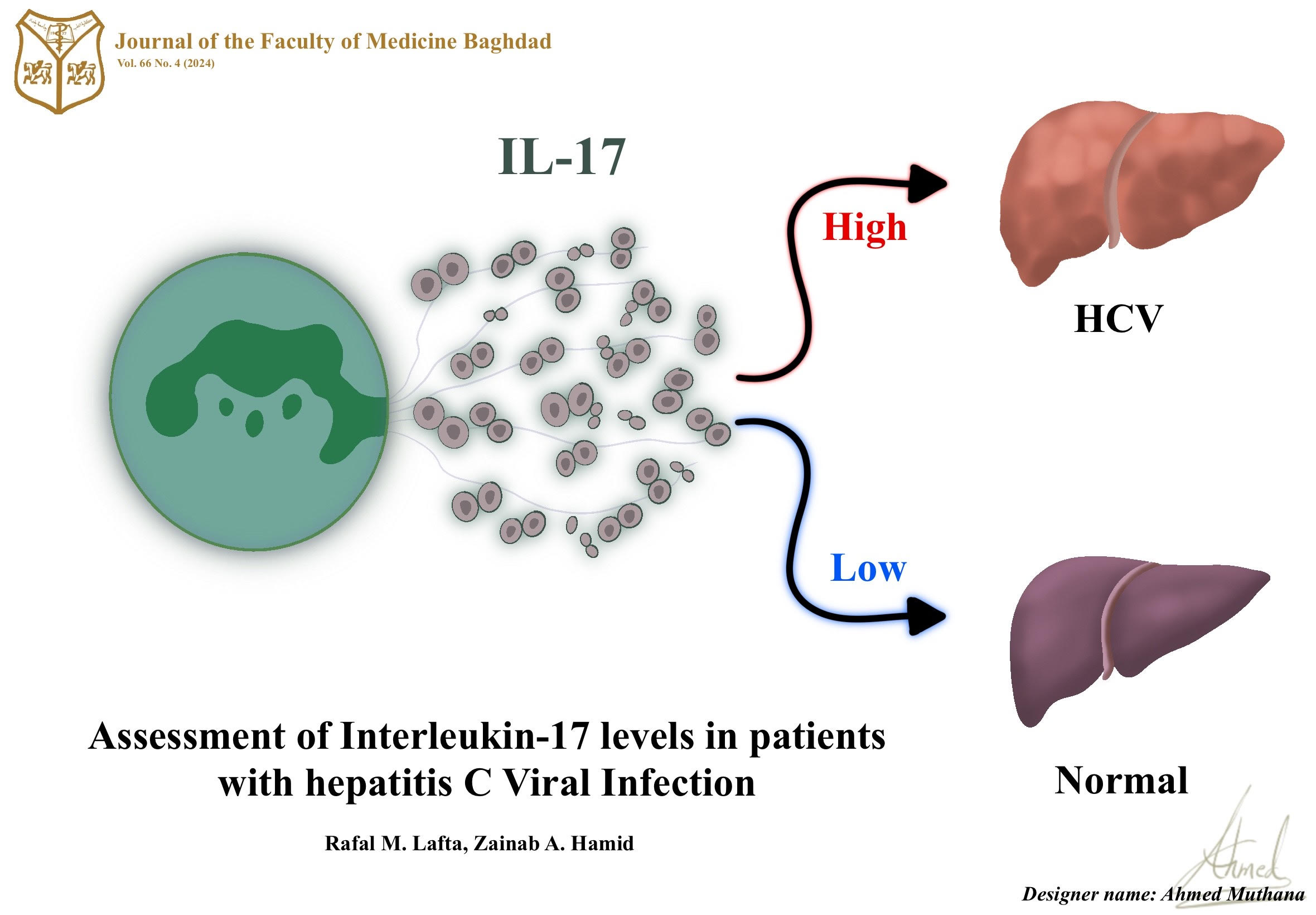 IL-17; Hepatitis C virus; HCV related interleukins; chronic hepatitis. 